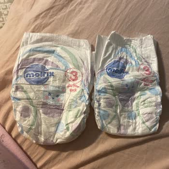 Aldığım Molfix Bebek Bezinde Üretim Hatası Ve İçerik Farklılığı