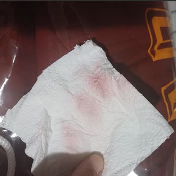 Yoğun Kimyasal Boya Nedeniyle Sağlığı Tehdit Eden Yatak Örtüsü Ve Çözüm Eksikliği