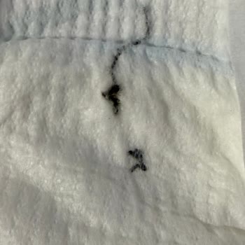 Bebek Bezinde Çıkan Siyah Cisim Nedeniyle Endişe Ve Hızlı Çözüm Talebi