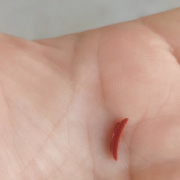 Dondurma İçinden Plastik Parça Çıkması Ve Kalite Kontrol Eksikliği