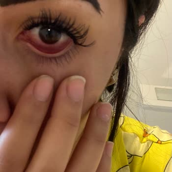 Özge Teoman Güzellik Merkezi'nden Şikayetçiyim