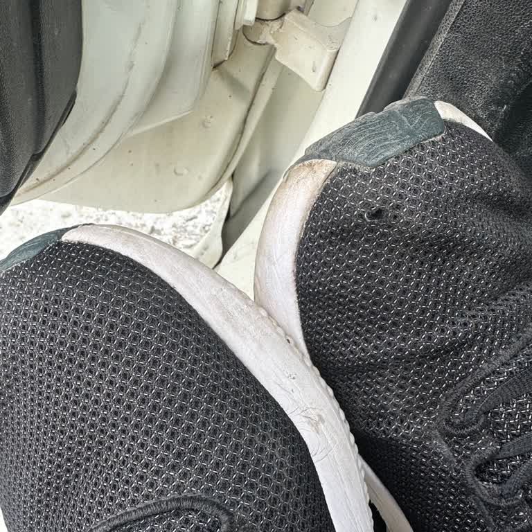 Kısa Sürede Deforme Olan Ayakkabı Ve Destek Eksikliği