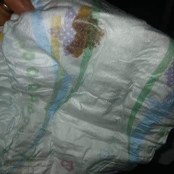 Molfix Bebek Bezinde Yapışkan Madde Ve Ciltte Kızarıklık Şoku