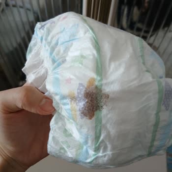 Molfix Bebek Bezinde Yapışkan Madde Ve Ciltte Kızarıklık Şoku