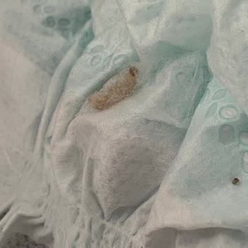 Prima Premium Care Bebek Bezinde Canlı Tırtıl Çıktı