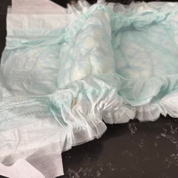 Prima Premium Care Bebek Bezinde Canlı Tırtıl Çıktı