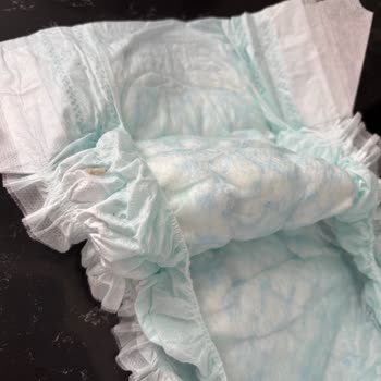 Prima Premium Care Bebek Bezinde Canlı Tırtıl Çıktı