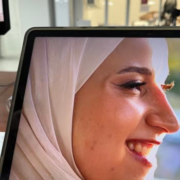 Nişan Günü Makyaj Hizmetinde Yaşanan Mağduriyet Ve İletişim Sorunu