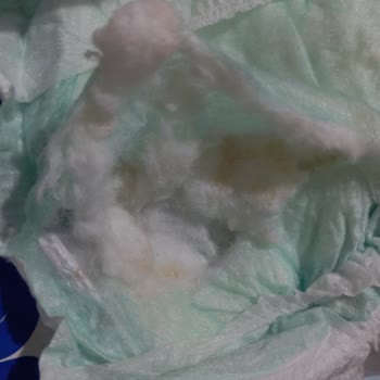 Aldığım Molfix Bebek Bezi Topaklandı, Mağduriyetim Giderilsin!