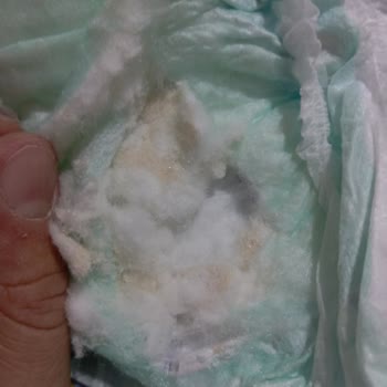 Aldığım Molfix Bebek Bezi Topaklandı, Mağduriyetim Giderilsin!