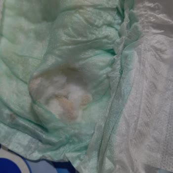 Aldığım Molfix Bebek Bezi Topaklandı, Mağduriyetim Giderilsin!