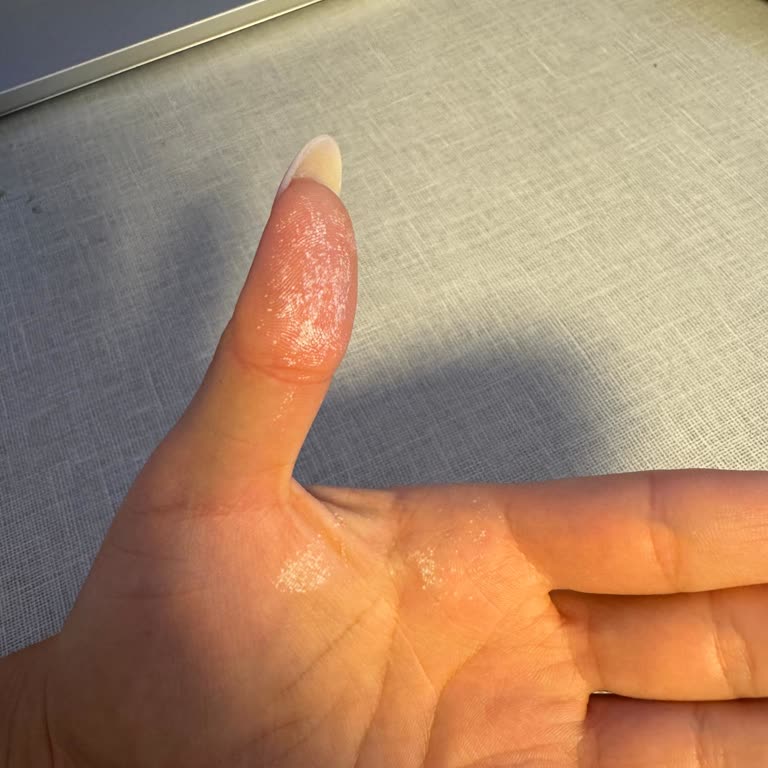 Vanish Oxi Action Jel Cildimde Yanma Ve Leke Oluşturdu!