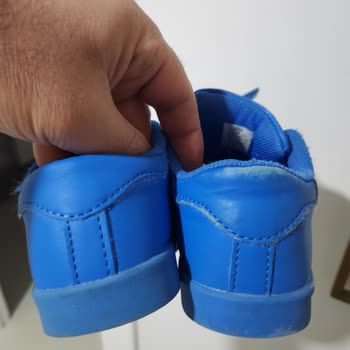 Bir Haftada Deforme Olan Ayakkabıya Sıfır Destek!