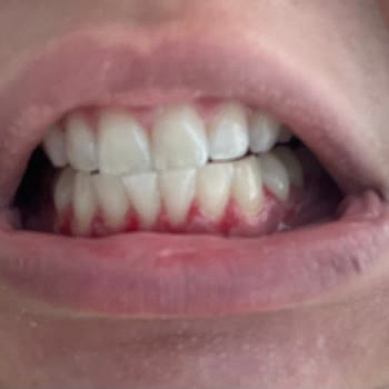 Özel Mustafa Kemal Ağız Ve Diş Sağlığı Polikliniği&nbsp; Hem Maddi Hem De Manevi Olarak Zarar Gördüm