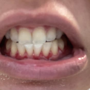 Özel Mustafa Kemal Ağız Ve Diş Sağlığı Polikliniği&nbsp; Hem Maddi Hem De Manevi Olarak Zarar Gördüm