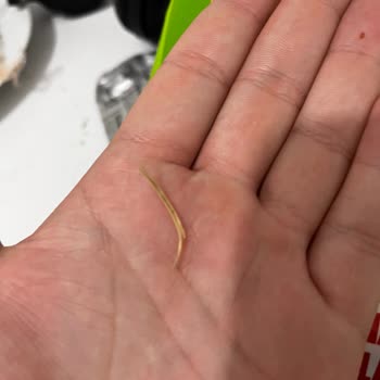 Cipso Cips Paketinden Yabancı Madde Çıkması Ve Güvenlik Endişesi