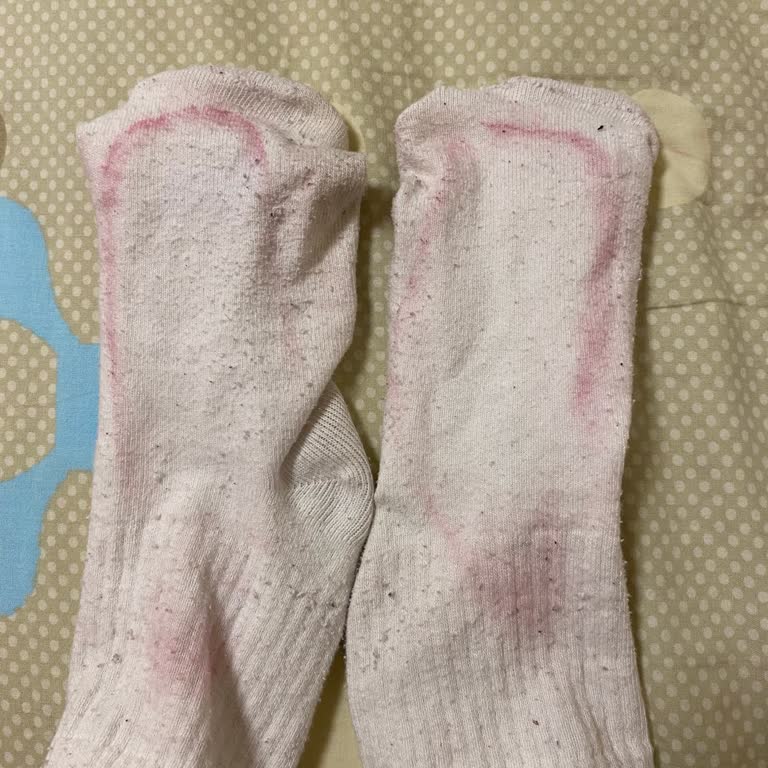 6.000 TL’lik Adidas Ayakkabı Boya Veriyor, Mağaza İlgisizliği Hayal Kırıklığı Yarattı