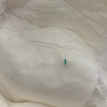 Bebek Bezinde Yabancı Madde: Bebeğimin Sağlığı Tehlikeye Girdi