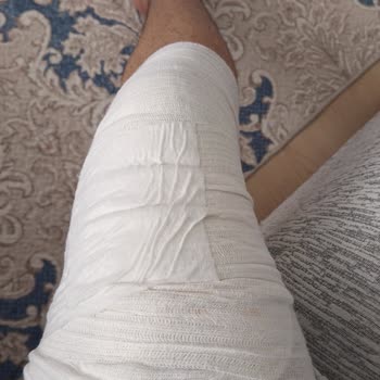 Seyir Halindeyken Direksiyon Demiri Kırıldı, Maddi Ve Fiziksel Zarara Uğradım