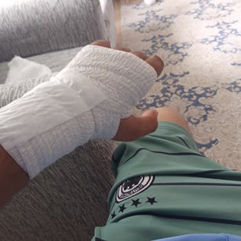 Seyir Halindeyken Direksiyon Demiri Kırıldı, Maddi Ve Fiziksel Zarara Uğradım