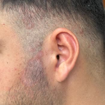 Sahte Ürün Ve İade Reddi Nedeniyle Sağlık Sorunu Yaşadım