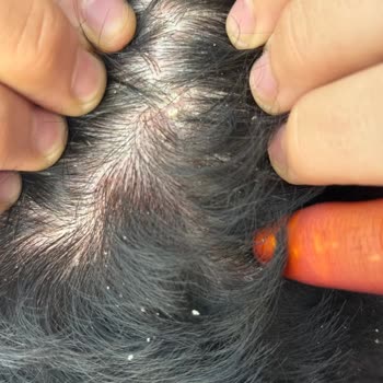 Sahte Ürün Ve İade Reddi Nedeniyle Sağlık Sorunu Yaşadım