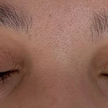 Caudalie Micellar Temizleme Suyu Gözlerimde Yanma ve Şişlik Yaptı