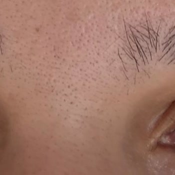 Caudalie Micellar Temizleme Suyu Gözlerimde Yanma ve Şişlik Yaptı