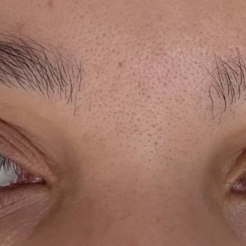 Caudalie Micellar Temizleme Suyu Gözlerimde Yanma ve Şişlik Yaptı