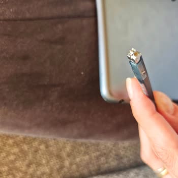 Kısa Sürede Paslanan Ve Kırılan Gözlük İçin Yetersiz Servis Ve Çözüm