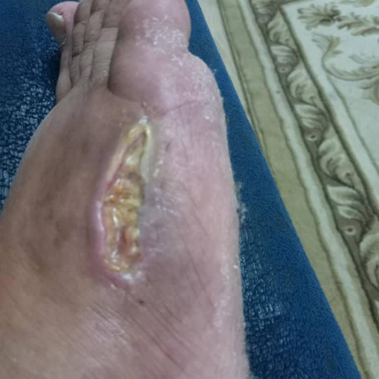 Sompo Trafik Kazası Sonrası Bedeni Hasar Tazminatım Bir Yıldır Ödenmedi