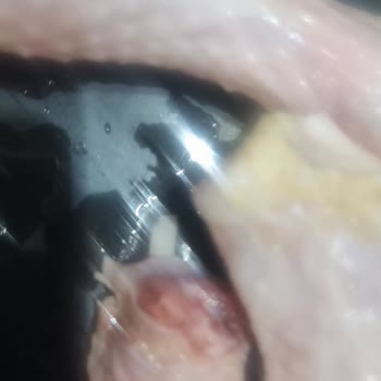 Aldığım Tavuk Butlarında Renk Değişimi Ve Şüpheli Görüntü