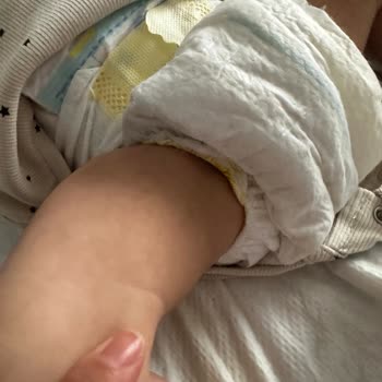 Prima Bebek Bezlerinde Sürekli Sızdırma Sorunu Aileyi Endişelendiriyor