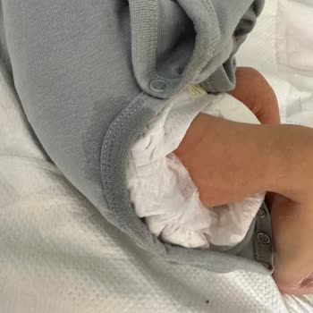 Prima Bebek Bezlerinde Sürekli Sızdırma Sorunu Aileyi Endişelendiriyor