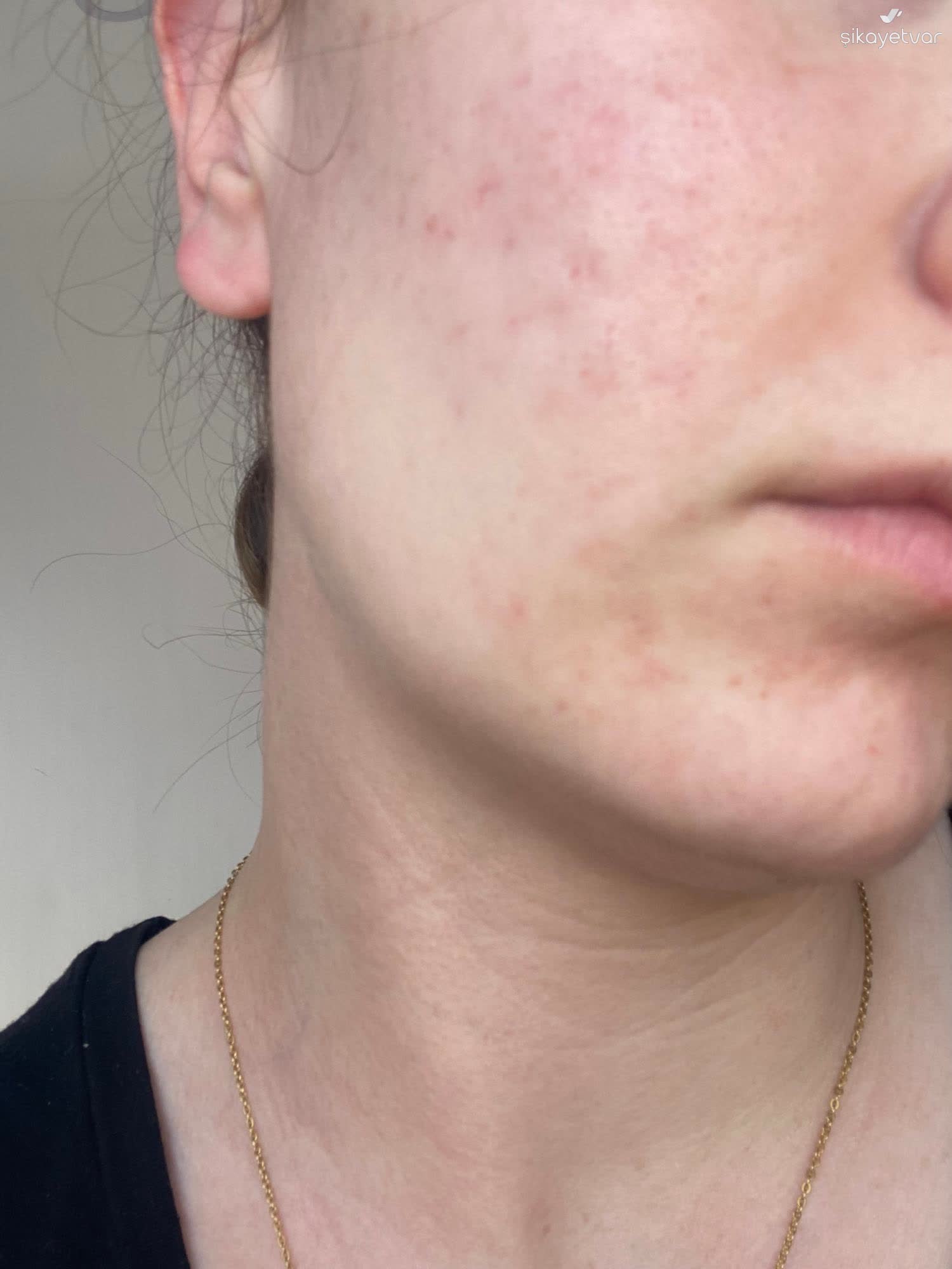 aloe vera fr wunden Gesichtsbehandlungsgel mit 95 % Aloe Vera  beruhigt, repariert und spendet  der Haut Feuchtigkeit