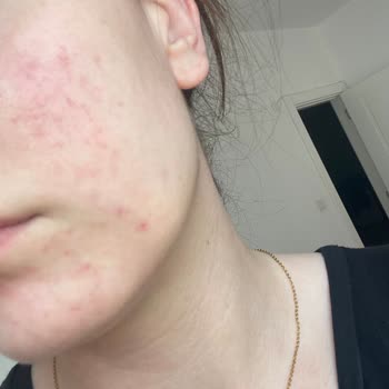 Sözleşme İptali Ve Ücret İadesi Taleplerim Karşılanmadı, Hizmetten Memnun Kalmadım