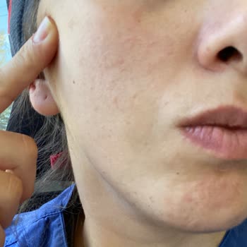 Crema Institut Esthederm dejó marcas en mi rostro, falta de atención