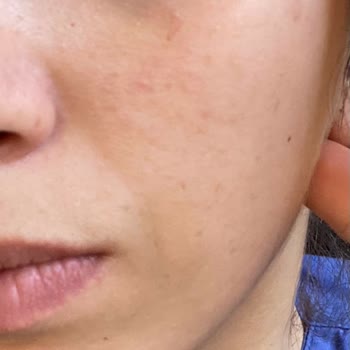 Crema Institut Esthederm dejó marcas en mi rostro, falta de atención