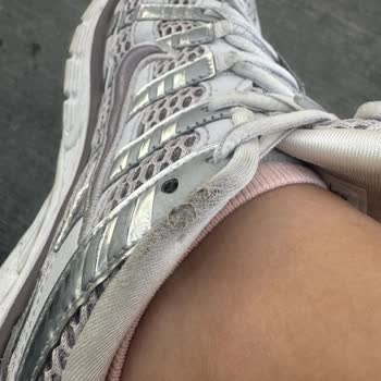 Nike Mağazasından Alınan Ayakkabıda Kısa Sürede Yırtılma Ve Soyulma Yaşadım