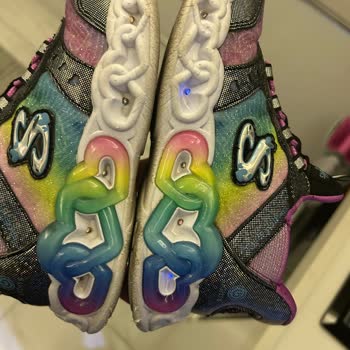 Skechers 25 Günde Işıkları Bozulan Ve Yıpranan Ayakkabıya Çözüm Sunulmadı