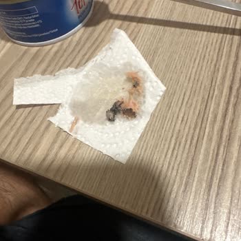 Ton Balığında Siyah Yabancı Maddeyle Karşılaştım, İnceleme Talep Ediyorum