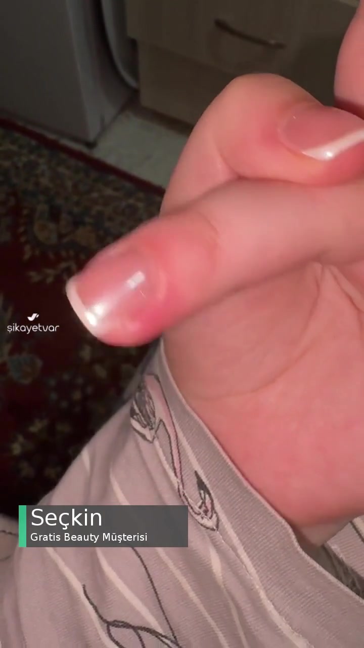 Gratis Beauty Tırnak İltihabı Sorunu videonun kapak resmi