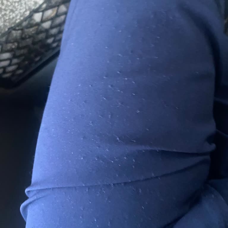 Kısa Sürede Tüylenen Takım Elbise Ve İlgisiz Müşteri Hizmetleri