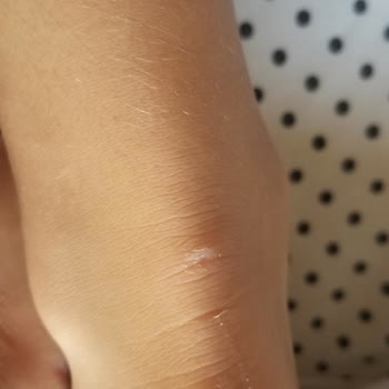 Vans Old Skool Ayakkabı Kızımın Ayağında Yaraya Sebep Oldu, Değişim Veya İade Talebim Var