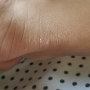 Vans Old Skool Ayakkabı Kızımın Ayağında Yaraya Sebep Oldu, Değişim Veya İade Talebim Var