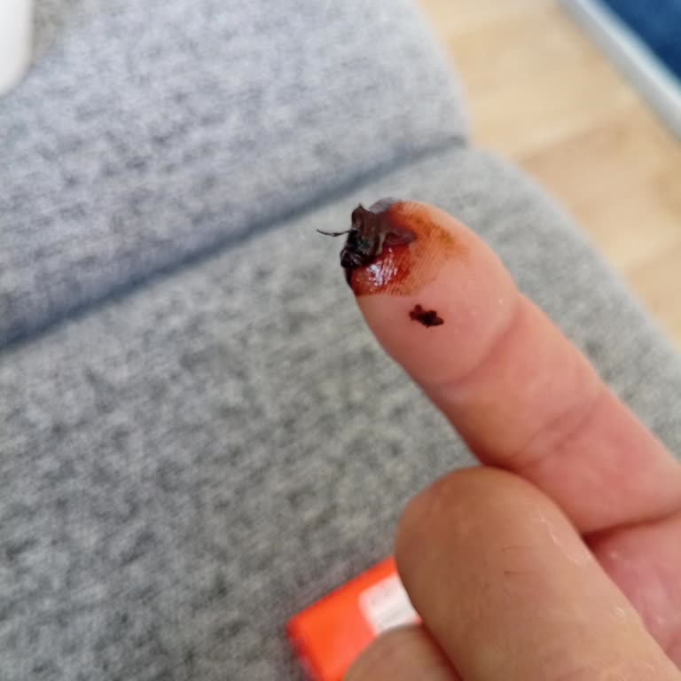 Kahve Paketinde Sinek Çıkması Nedeniyle Yaşanan Rahatsızlık