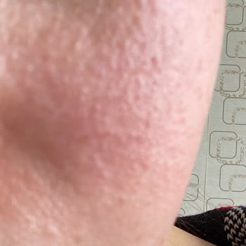 Cream Co. Moisturizer Nemlendiriciyi Cildimi Mahvetti