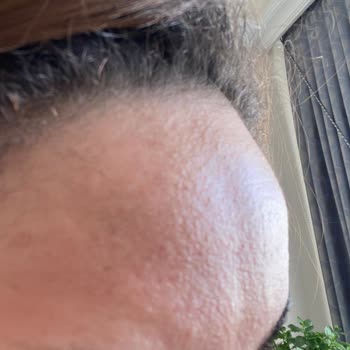 Cream Co. Moisturizer Nemlendiriciyi Cildimi Mahvetti