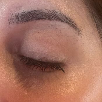 Kozmetik Ürün Gözümde Şişlik Ve Yanma Yaptı, Çözüm Bekliyorum