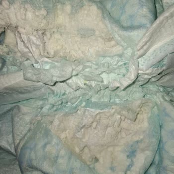 Prima Bebek Bezlerinde Partikül Sorunu Ve Yetersiz Müşteri Hizmeti